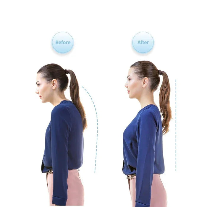Vasper Smart Posture Corrector - Neck Hump Straightener Improve Your Posture for Adult and Kid